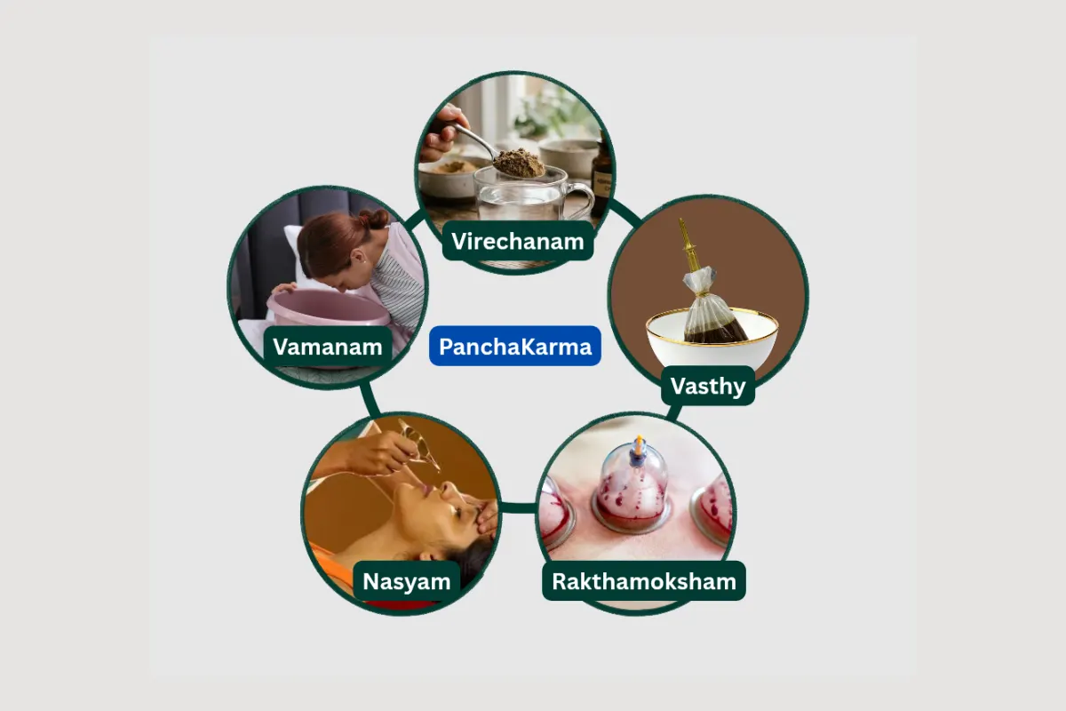 Best Panchakarma treatment center in Sharjah UAE