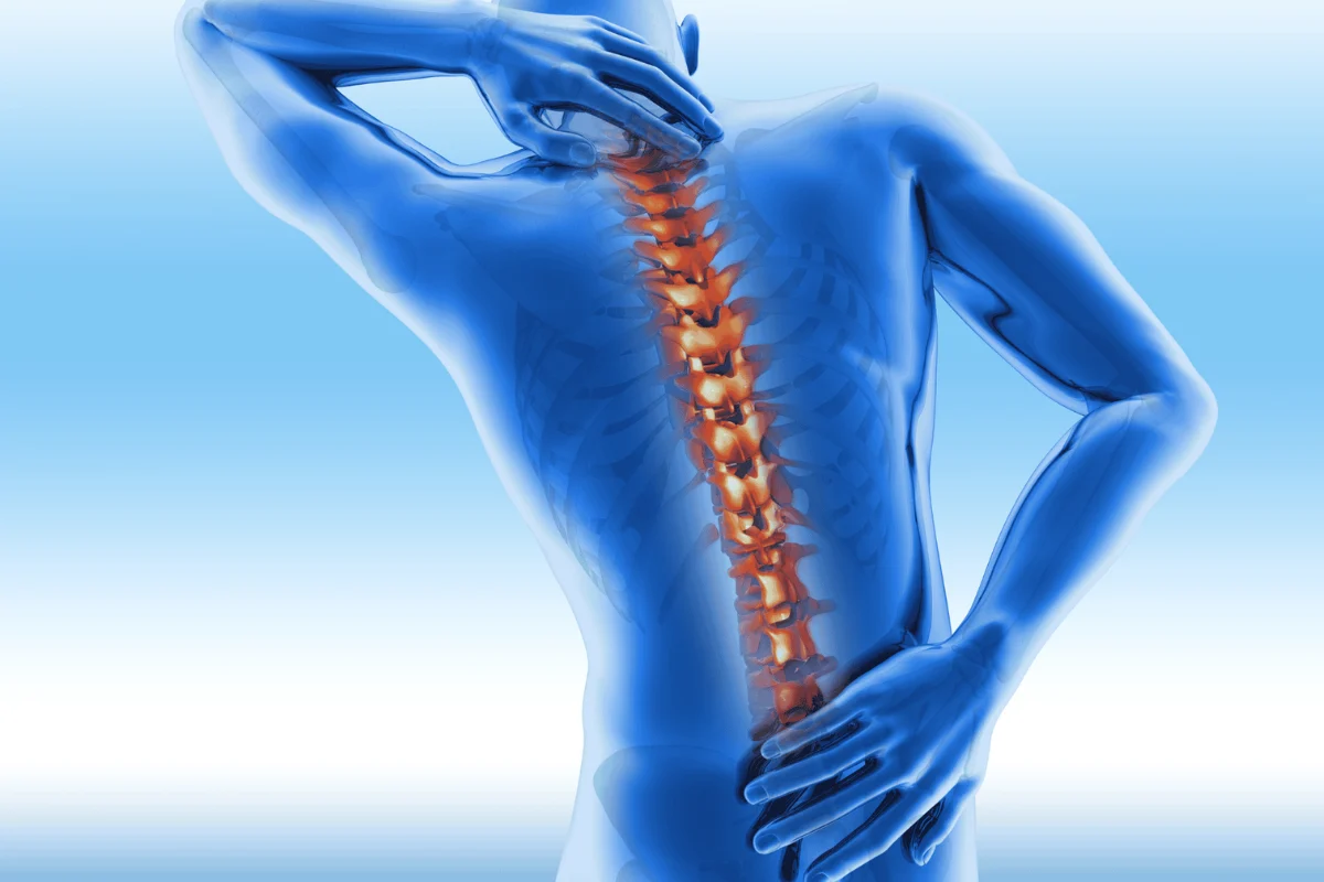 Ankylosing Spondylitis Treatment in Sharjah UAE